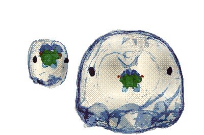 Ant brain